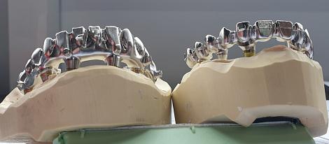 Челябинская компания «Биомеханика» запускает производство дентальных компонентов для зубных имплантатов