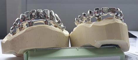 Заемщик ФРП запустил в Челябинске производство компонентов для зубных имплантатов